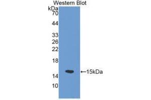 Western blot analysis of the recombinant protein. (SLC30A5 anticorps  (AA 639-751))