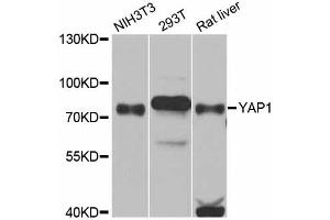 Western blot analysis of extracts of various cell lines, using YAP1 antibody (ABIN5974703) at 1/1000 dilution. (YAP1 anticorps)