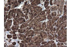 Image no. 5 for anti-Carboxypeptidase A2 (Pancreatic) (CPA2) antibody (ABIN1497598)