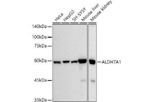 Western blot analysis of extracts of various cell lines, using  antibody (ABIN7265544) at 1:500 dilution. (ALDH7A1 anticorps)