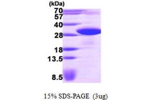 SDS-PAGE (SDS) image for VAMP (Vesicle-Associated Membrane Protein)-Associated Protein B and C (VAPB) (AA 1-222) protein (His tag) (ABIN667277)