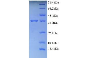 SDS-PAGE (SDS) image for Glycophorin A (GYPA) (AA 20-91), (Extracellular) protein (GST tag) (ABIN5709633)