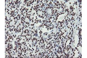 Immunohistochemical staining of paraffin-embedded Human breast tissue using anti-NONO mouse monoclonal antibody. (NONO anticorps  (AA 184-385))
