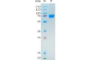 Human Protein, hFc Tag on SDS-PAGE under reducing condition.