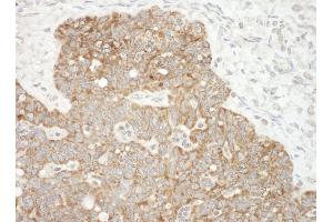 Immunohistochemistry (IHC) image for anti-Apoptosis-Inducing Factor, Mitochondrion-Associated, 1 (AIFM1) (AA 563-613) antibody (ABIN7454866)