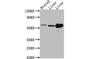 Western Blot Positive WB detected in: Ntera-2 whole cell lysate, Mouse Liver whole cell lysate, Rat Liver cell lysate All lanes: ALDH2 antibody at 1:1000 Secondary Goat polyclonal to rabbit IgG at 1/50000 dilution Predicted band size: 57, 51 kDa Observed band size: 57 kDa (Recombinant ALDH2 anticorps)