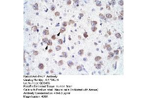 Human Brain (Raly anticorps  (N-Term))