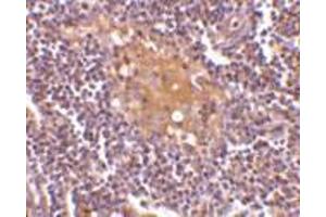 Immunohistochemistry of AIM in human lymph node tissue with AIM antibody at 10 μg/ml.