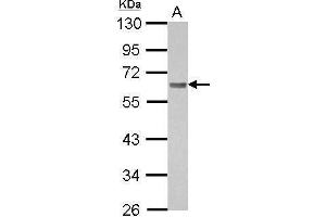 WB Image Sample (30 ug of whole cell lysate) A: A431 10% SDS PAGE antibody diluted at 1:1000 (BIN1 anticorps)