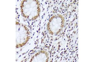 Immunohistochemistry of paraffin-embedded human appendix using Phospho-c-Abl-Y412 antibody (ABIN7265966) at dilution of 1:100 (40x lens). (ABL1 anticorps  (pTyr412))