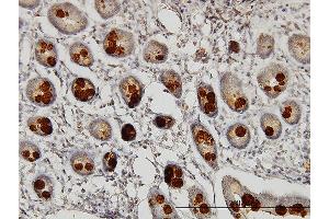 Immunoperoxidase of monoclonal antibody to ABHD5 on formalin-fixed paraffin-embedded human small Intestine. (ABHD5 anticorps  (AA 1-349))