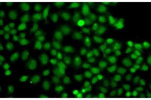 Immunofluorescence analysis of A549 cells using PIP5K1A Polyclonal Antibody (PIP5K1A anticorps)