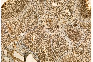 ABIN6264546 and ABIN6272948 at 1/100 staining Rat ovary tissue by IHC-P. (QSOX1 anticorps  (Internal Region))