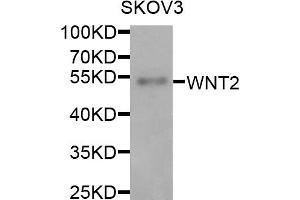Western blot analysis of extracts of SKOV3 cells, using WNT2 antibody. (WNT2 anticorps)
