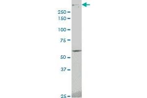 PRKDC monoclonal antibody (M02), clone 1B9 Western Blot analysis of PRKDC expression in A-431 .