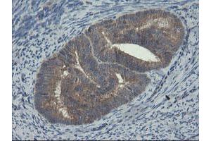 Image no. 2 for anti-Copper Metabolism (Murr1) Domain Containing 1 (COMMD1) antibody (ABIN1497563)