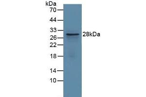 Detection of Recombinant GCLM, Human using Polyclonal Antibody to Glutamate Cysteine Ligase, Modifier Subunit (GCLM) (GCLM anticorps  (AA 40-251))