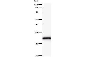 Western Blotting (WB) image for anti-Iroquois Homeobox Protein 5 (IRX5) antibody (ABIN930959)