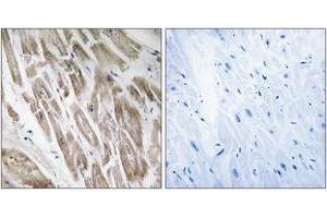 Immunohistochemistry analysis of paraffin-embedded human heart, using NDUFS5 Antibody.