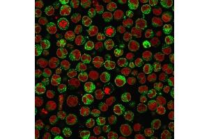 Immunofluorescence Analysis of PFA-fixed Raji cells labeling CD79a with CD79a Monoclonal Antibody (SPM550) followed by Goat anti-Mouse IgG-CF488 (Green). (CD79a anticorps  (AA 202-216))