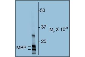 Western blot of rat cortex homogenate showing specific immunolabeling of the ~18 & 22k MBP protein. (MBP anticorps)