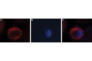 Expression of FSH receptor in human ovary cell line - Cell surface detection of FSH receptor in intact living human OVCAR3 cells.