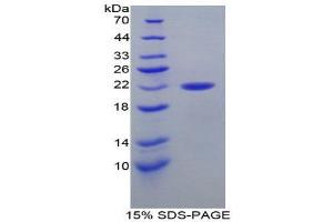SDS-PAGE (SDS) image for Calreticulin (CALR) (AA 199-308) protein (His tag) (ABIN1877167)