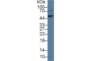 Detection of vWA1 in Rat Testis lysate using Polyclonal Antibody to Von Willebrand Factor A Domain Containing Protein 1 (vWA1)