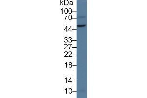 Detection of vWA1 in Rat Testis lysate using Polyclonal Antibody to Von Willebrand Factor A Domain Containing Protein 1 (vWA1) (VWA1 anticorps  (AA 42-289))