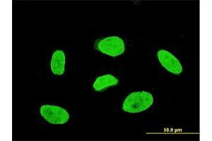 Immunofluorescence of monoclonal antibody to TBX3 on HeLa cell. (TBX3 anticorps  (AA 311-410))