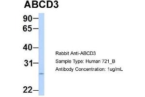 Host: Rabbit Target Name: ABCD3 Sample Type: Human 721_B Antibody Dilution: 1.