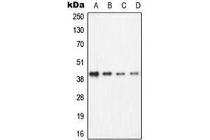 Western blot analysis of ECA39 expression in Jurkat (A), Ramos (B), NIH3T3 (C), PC12 (D) whole cell lysates. (BCAT1 anticorps  (C-Term))