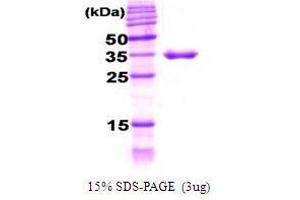 Figure annotation denotes ug of protein loaded and % gel used. (DNAJB6 Protein (AA 1-376))
