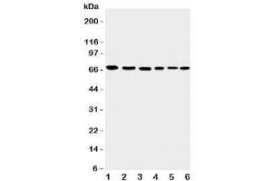 Western blot testing of Apoptosis-Inducing Factor antibody and Lane 1:  rat heart (AIF anticorps  (C-Term))