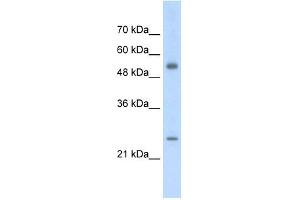 AK3L1 antibody used at 2. (AK4 anticorps  (Middle Region))