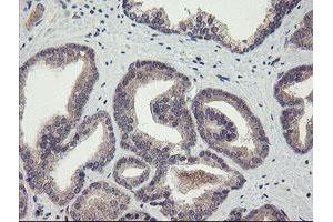 Image no. 7 for anti-rho GTPase Activating Protein 2 (ARHGAP2) antibody (ABIN1499627) (CHN1 anticorps)