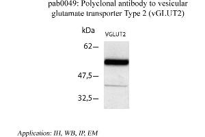 Image no. 1 for anti-Solute Carrier Family 17 (Vesicular Glutamate Transporter), Member 6 (SLC17A6) (C-Term) antibody (ABIN346995) (Solute Carrier Family 17 (Vesicular Glutamate Transporter), Member 6 (SLC17A6) (C-Term) anticorps)