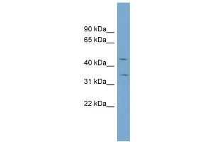 WB Suggested Anti-SLC39A8 Antibody Titration:  0.