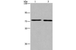 Western Blot analysis of Human fetal brain and Mouse brain tissue using KCNQ4 Polyclonal Antibody at dilution of 1:200