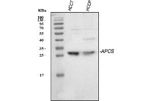 Western blot analysis of Serum Amyloid P/APCS using anti-Serum Amyloid P/APCS antibody (ABIN5693182).