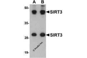 Western Blotting (WB) image for anti-Sirtuin 3 (SIRT3) (Middle Region) antibody (ABIN1031094) (SIRT3 anticorps  (Middle Region))