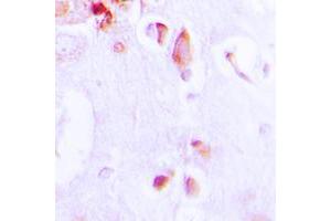Immunohistochemical analysis of ARRDC3 staining in human brain formalin fixed paraffin embedded tissue section. (ARRDC3 anticorps  (C-Term))