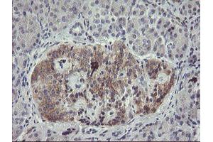 Immunohistochemical staining of paraffin-embedded Human pancreas tissue using anti-EIF5A2 mouse monoclonal antibody. (EIF5A2 anticorps)