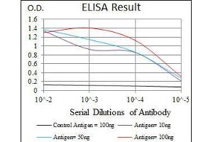 Black line: Control Antigen (100 ng), Purple line: Antigen(10 ng), Blue line: Antigen (50 ng), Red line: Antigen (100 ng), (CCL2 anticorps)