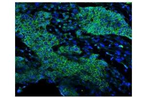 IF analysis of EGFR using anti-EGFR antibody (ABIN7601478).