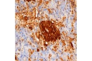 Staining of paraffin embedded human pancreas with mouse anti rat Insulin. (Insulin anticorps)