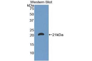 Western blot analysis of the recombinant protein. (CD8B anticorps  (AA 22-170))