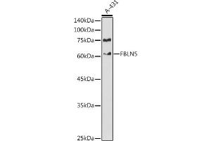 Western blot analysis of extracts of A-431 cells, using FBLN5 antibody (ABIN6127927, ABIN6140497, ABIN6140498 and ABIN6225300) at 1:1000 dilution.