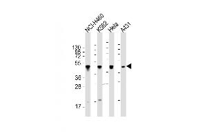 All lanes : Anti-CYK18 Antibody (C-term) at 1:2000 dilution Lane 1: NCI- whole cell lysate Lane 2: K562 whole cell lysate Lane 3: Hela whole cell lysate Lane 4: A431 whole cell lysate Lysates/proteins at 20 μg per lane.
