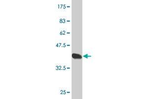 Western Blot detection against Immunogen (37.